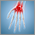 Treatment Options for Common Hand Afflictions