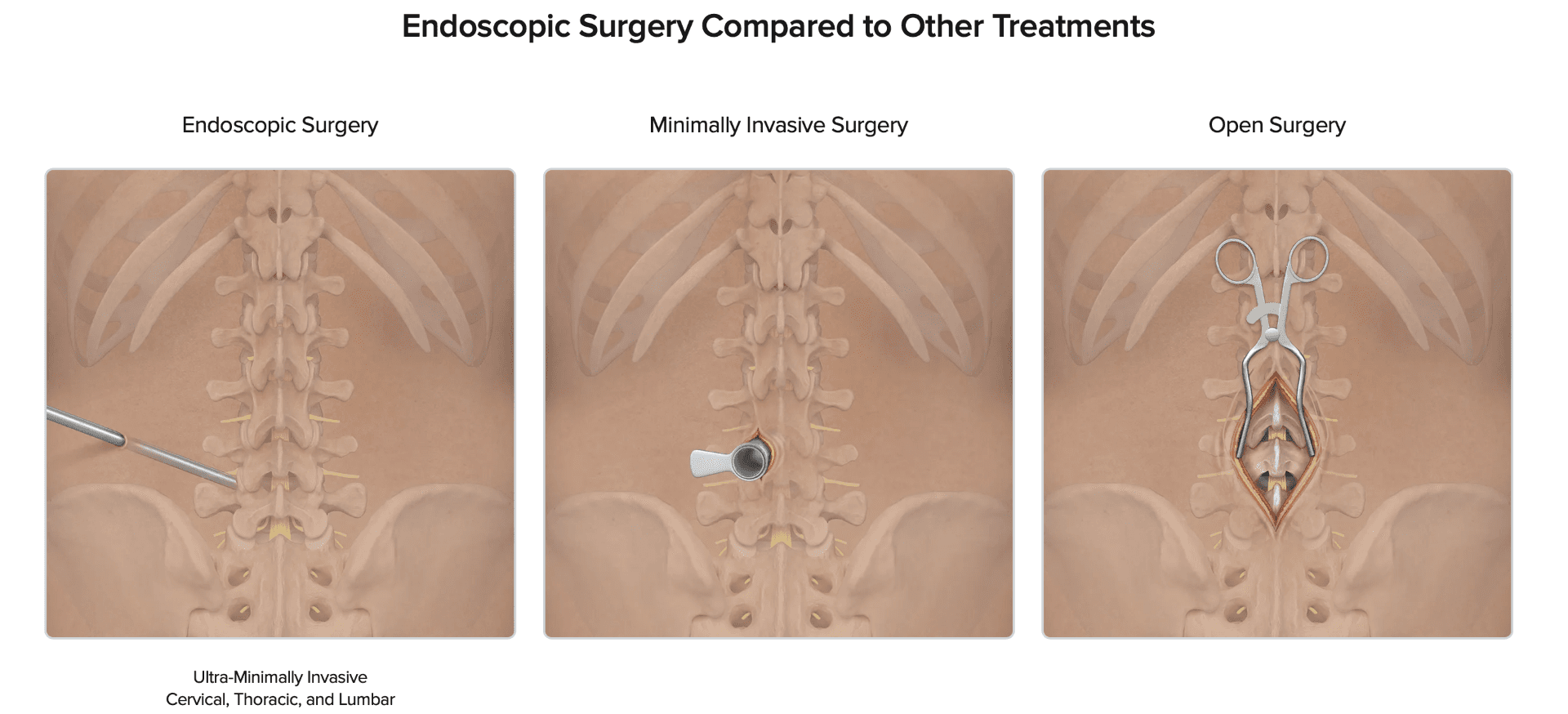 Arthrex Endoscopic Surgery Comparison Image